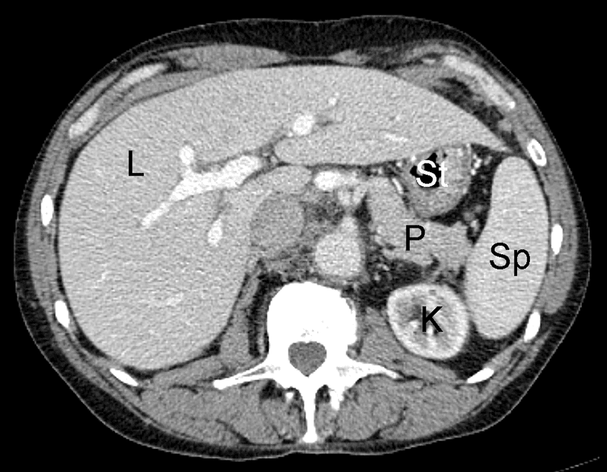 Le Centre Radiologie Tanger propose des scanners abdominaux précis pour diagnostiquer et suivre diverses pathologies. Contactez-nous pour un examen fiable et rapide ! 
