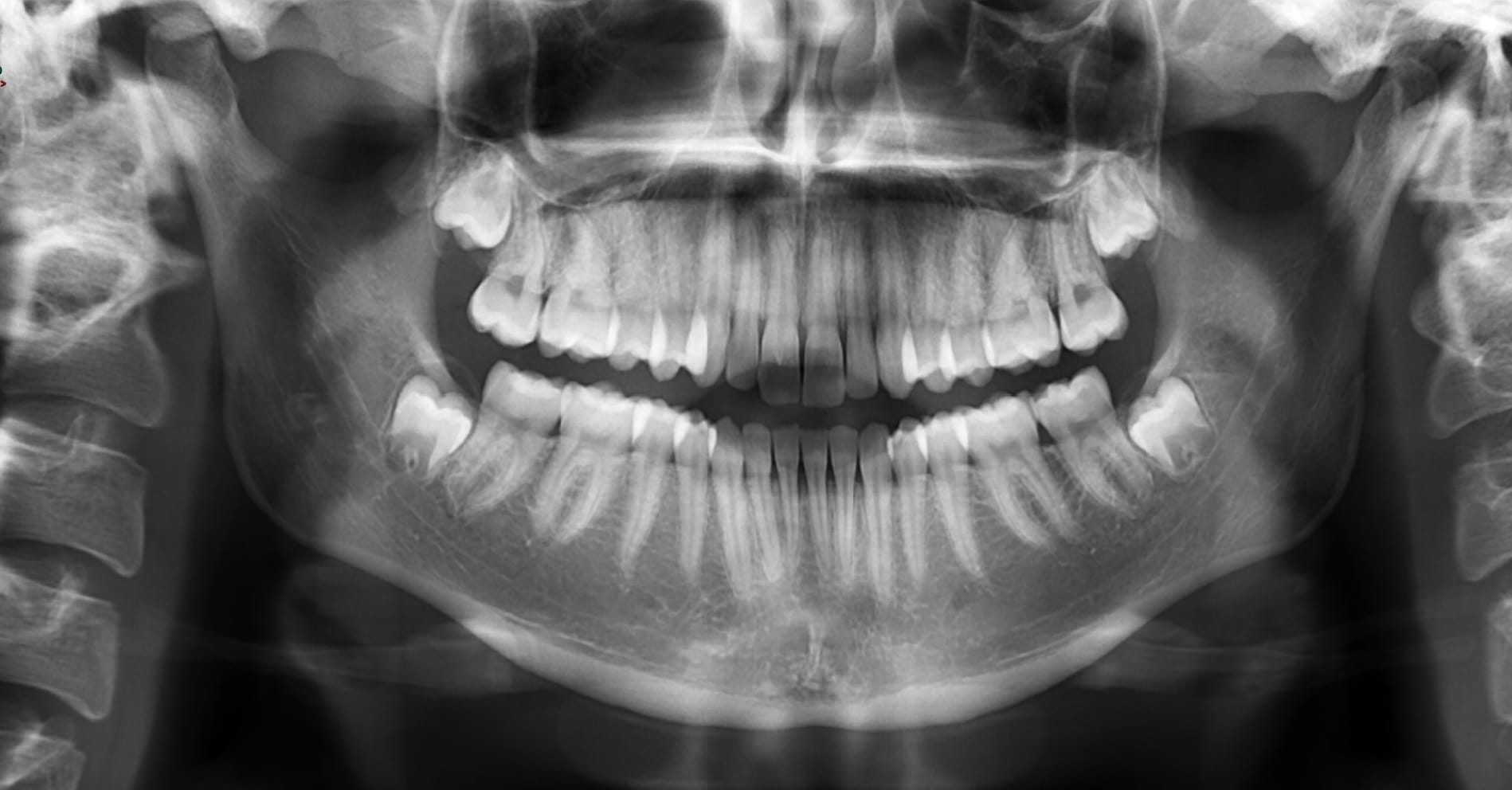 Image de radiologie dentaire au Centre Radiologie Tanger pour un diagnostic précis. Outil essentiel pour des soins bucco-dentaires de qualité.