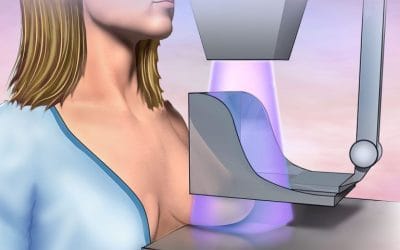 Centre Radiologie Tanger : Résultats Mammographie