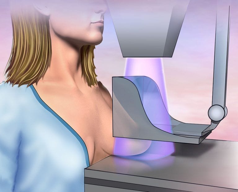 Image d'une mammographie montrant une vue détaillée du tissu mammaire pour dépister d'éventuelles anomalies.