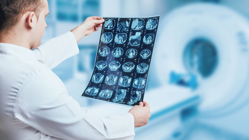Scanner TDM Multi-Barette en action au Centre Radiologie Tanger, offrant des images de haute précision pour des diagnostics optimaux.